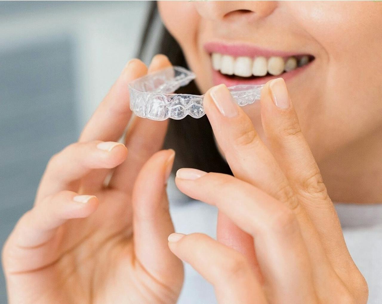 invisalign braces in hemel hempstead